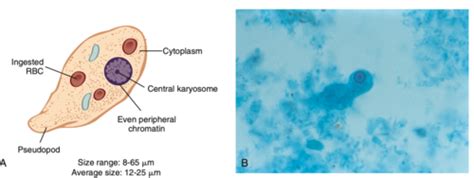 emeba|amoeba identification.